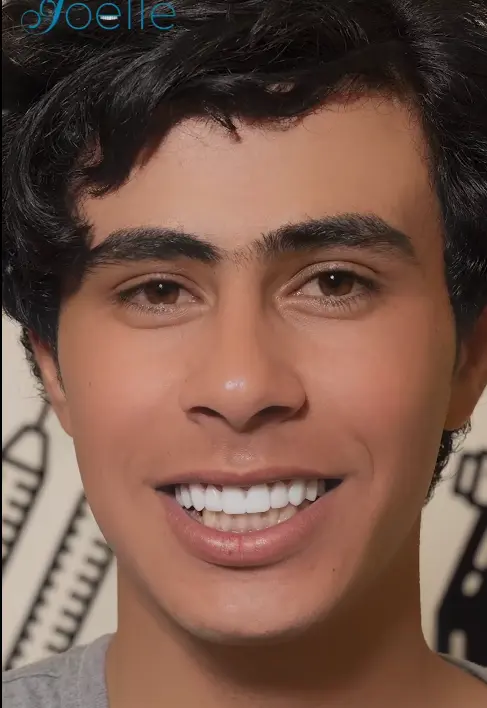 Dentist node
