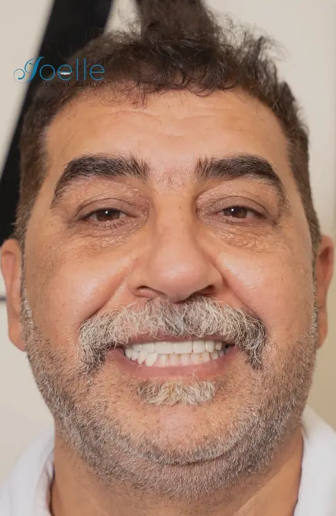 Dentist node