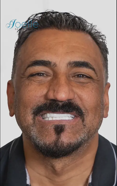 Dentist node